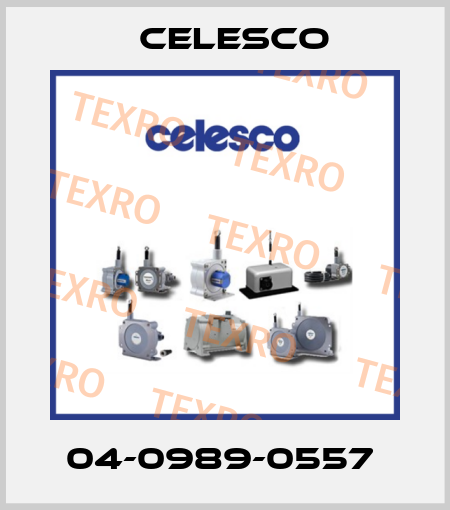 04-0989-0557  Celesco